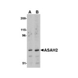 ProSci 4743 ASAH2 Antibody