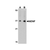 ProSci 4753 NENF Antibody