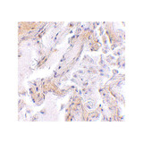 ProSci 4759 CAPN6 Antibody