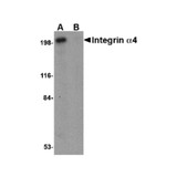 ProSci 4783 Integrin alpha 4 Antibody