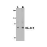 ProSci 4797 KINDLIN3 Antibody