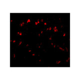 ProSci 4843 Spred1 Antibody