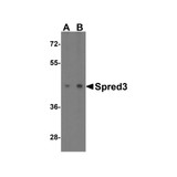 ProSci 4851 Spred3 Antibody
