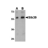 ProSci 4867 Stk39 Antibody