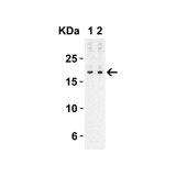 ProSci 4887 IL-17 Antibody