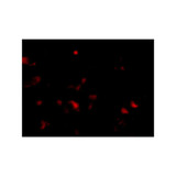 ProSci 4921 JPH3 Antibody