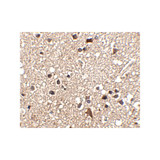 ProSci 4921 JPH3 Antibody