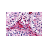 ProSci 4925 PTCHD2 Antibody