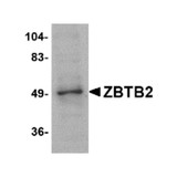 ProSci 4961 ZBTB2 Antibody