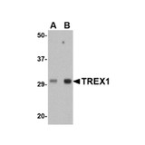ProSci 4969 TREX1 Antibody