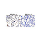ProSci 9099-HRP SARS-CoV-2 (COVID-19) Nucleocapsid Antibody