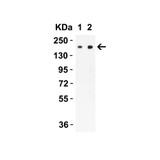 ProSci PM-9428 SARS-CoV-2 (COVID-19) Spike S2 Antibody
