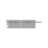ProSci PM-7813 Vinculin Antibody