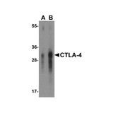 ProSci RF16013 CTLA4 Antibody