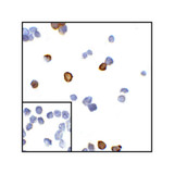 ProSci RF16013 CTLA4 Antibody
