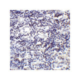 ProSci RF16021 PDL2 Antibody
