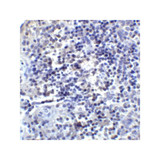 ProSci RF16022 PDL2 Antibody