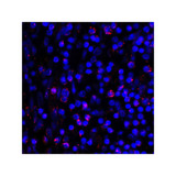 ProSci RF16038 PDL1 Antibody