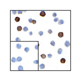 ProSci RF16063 LIGHT Antibody