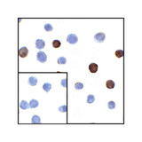 ProSci RF16064 LIGHT Antibody