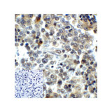 ProSci RF16086 LAG3 Antibody
