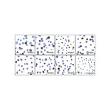 (GS1-7021) PDL1 Detection Set (Risk Free) ProSci 1 Set/Unit