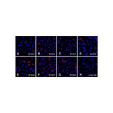 (GS1-7021) PDL1 Detection Set (Risk Free) ProSci 1 Set/Unit