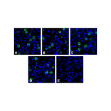(GS1-7066) LIGHT Detection Set (Risk Free) ProSci 1 Set/Unit