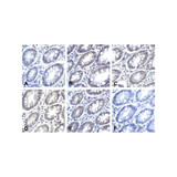 (GS1-7010) PDL2 Detection Set (Risk Free) ProSci 1 Set/Unit