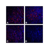 (GS1-7003) CTLA4 Detection Set (Risk Free) ProSci 1 Set/Unit