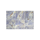 (GS1-7156) LAG3 Detection Set ProSci 1 Set/Unit