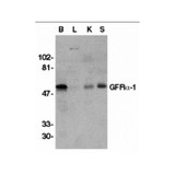 ProSci 1133 GFR alpha 1 Antibody
