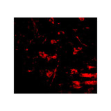 ProSci 5051 RCAN2 Antibody