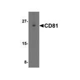 ProSci 5195 CD81 Antibody
