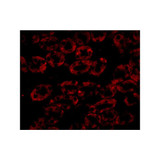 ProSci 5185 NPC1 Antibody