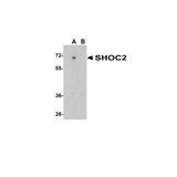 ProSci 5215 SHOC2 Antibody