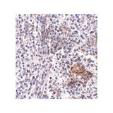 ProSci 5215 SHOC2 Antibody