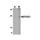ProSci 5655 EFHD1 Antibody