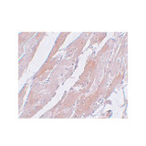 ProSci 5509 CCDC47 Antibody