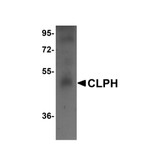 ProSci 5497 CLPH Antibody ProSci 5497 CLPH Antibody