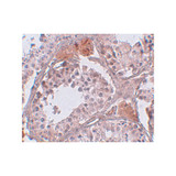ProSci 5497 CLPH Antibody ProSci 5497 CLPH Antibody