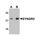 ProSci 5565 SYNGR2 Antibody