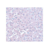 ProSci 5593 CALHM1 Antibody