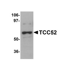 ProSci 5703 TCC52 Antibody