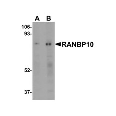 ProSci 5665 RANBP10 Antibody