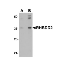 ProSci 5527 RHBDD2 Antibody