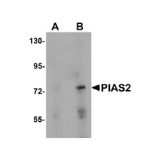 ProSci 5743 PIAS2 Antibody