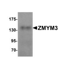 ProSci 6137 ZMYM3 Antibody