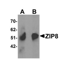 ProSci 6095 ZIP8 Antibody