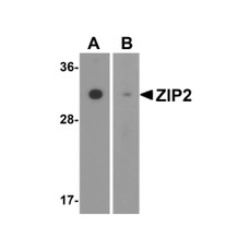 ProSci 6083 ZIP2 Antibody